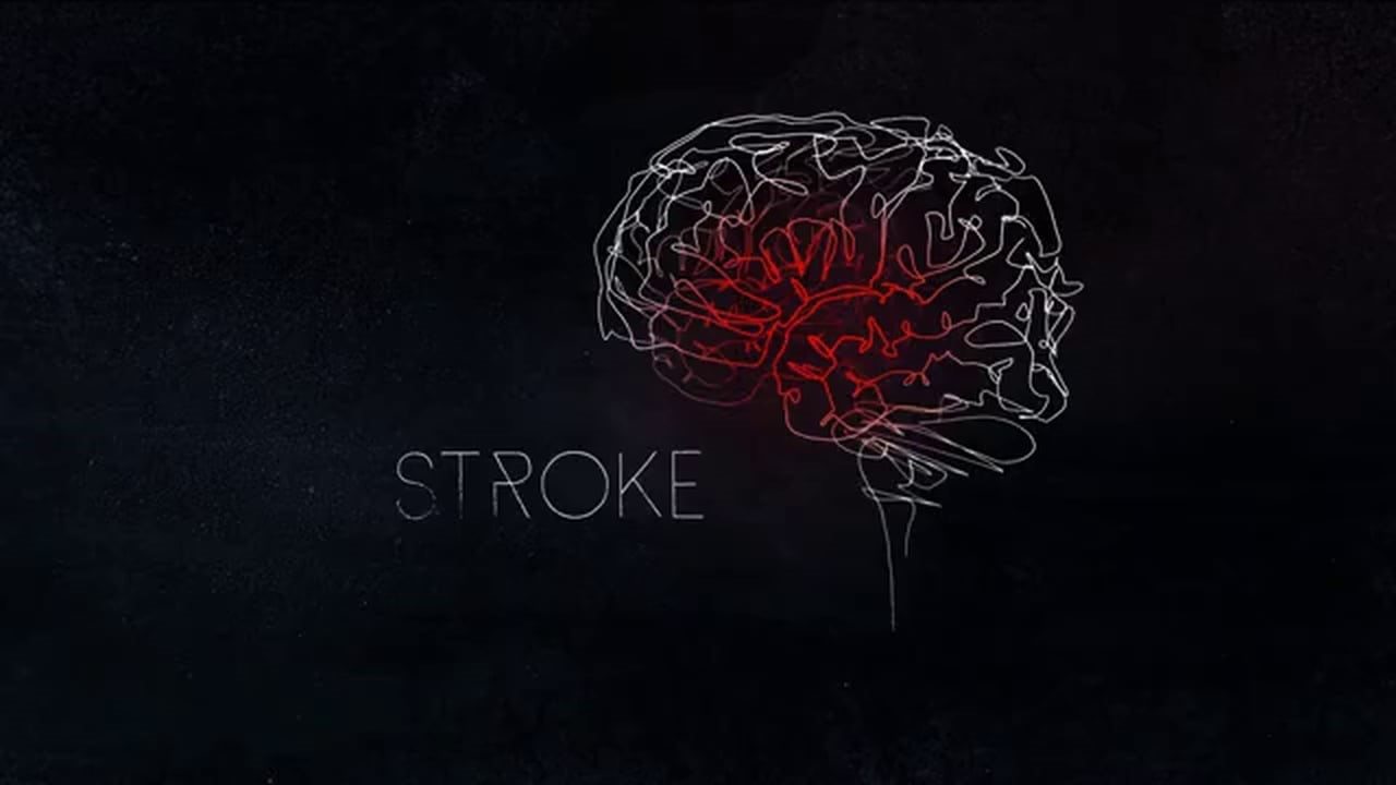 Comprehensive Stroke Core Measures News You Can Use Registry Partners