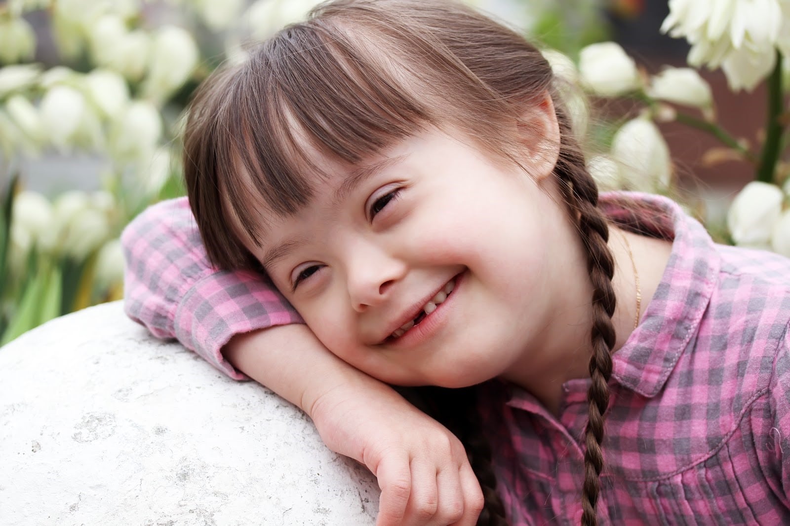 Quem tem síndrome de Down é deficiente?